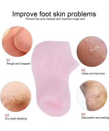 2 Pairs Silicone Socks Foot Moisturizing Socks Softening Dry Cracked Feet Rough Skins & Anti Slip Aloe Socks for Dry Cracked Feet Women Spa Pedicure Socks for Repairing Dry Asixxsixkg7d28uysa-14 - Buy Online on GoSupps.com