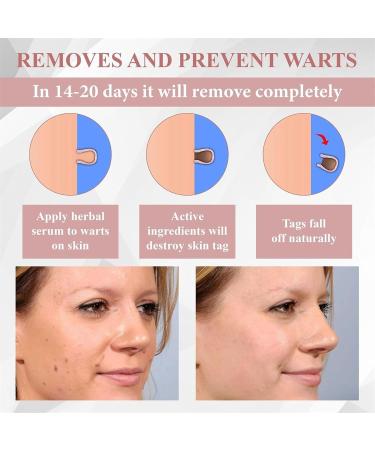 Impurities PeelOff Mask Skin Moisture Barrier Fast Absorption Moisturizer Natural Skin Care Beauty Gel For Women & Adults - Buy Online on GoSupps.com