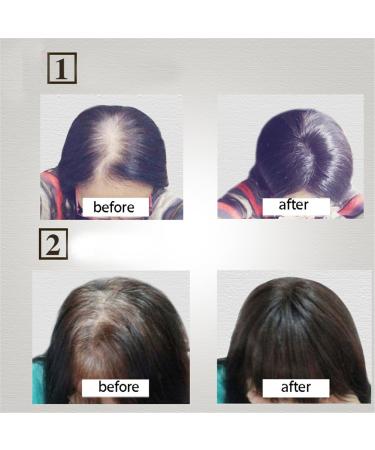 Buy Human Hair Toupee with Side Bangs for Women - 12 Inch Chestnut Brown Wig for Thinning Hair - International Shipping Available - Buy Online on GoSupps.com