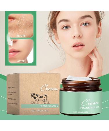  G n rique Grass-Fed Beef Tallow With Frankincense Oil & Castor Oil 100% Organic Beef Suet Moisturizer For Skin Deep Hydration And Nutrition For Body And Face (2) - Buy Online on GoSupps.com