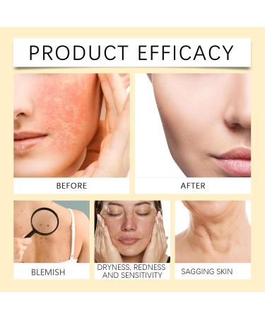 homomdy Bee Venom Multi Effect Cream Bee Venom Comprehensive Cream Antiaging Firming Lift Tightens Loose Skin Regains Elasticity Powerful Repair and Hydration 1pcs - Buy Online on GoSupps.com