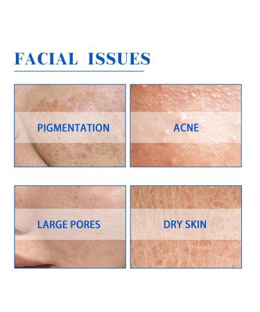 Moisturizing Toner & Face Cream - Deep Cleansing Anti-Wrinkle Brightening Hydrating Skin Care Essence(1PCS) - Buy Online on GoSupps.com