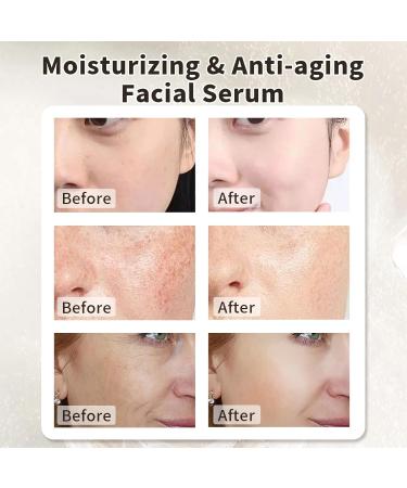 Alpha Arbutin Face Serum - 30ML Anti-Aging & Hydrating Serum for Acne Dark Spots & Fine Lines - 2% HA for Women - Buy Online on GoSupps.com