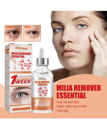Milia Remover Milia Spot Serum for Face Speedy Milia Remover Dark Spot Correcting Glow Serum Dark Circles Under Eye for Women & Men Anti Aging Anti Wrinkle Reduces Bags Saggy Skin & Puffy Eyes - Buy Online on GoSupps.com