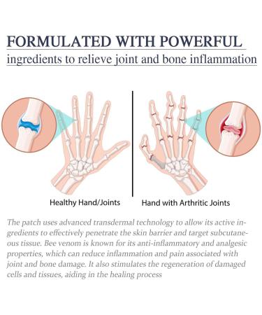 Cvreoz Bienenergift Warten Spray | Effective Bee Venom Treatment for Warts - 30ml (3PC) - Buy Online on GoSupps.com