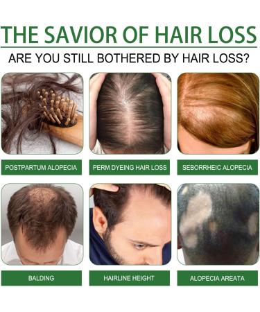 Rosemary Oil for Hair Growth Rosemary Oil for Skin Care Eyebrow and Eyelash Growth Nourishment Scalp & Dry Hair Strengthens Hair and Stimulates Hair Growth for Women Men(60 ML) - Buy Online on GoSupps.com