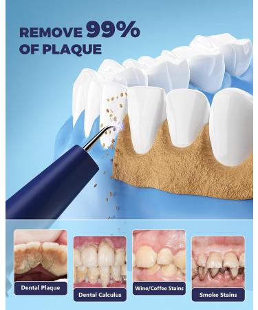 YUYUKO Plaque & Tartar Remover with LED Light | Dental Cleaning Kit - 3 Modes - Buy Online on GoSupps.com