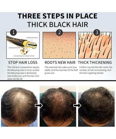 Natural Hair Growth Oil for All Hair Types - Nourishing Scalp Treatment (2pcs) - Buy Online on GoSupps.com