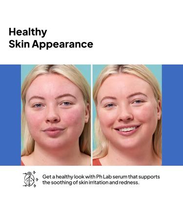 PhLab Anti Redness Serum Reduces Capillary Cracks Appearance Evens Skin Tone Skin Soothing and Redness Reform Serum 1.01 Fl Oz (Pack of 1) - Buy Online on GoSupps.com