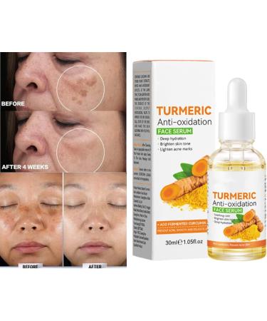 S rum anti-oxydation au curcuma S rumVisage anti-oxydation au curcuma S rumCorrecteur de taches brunes auCurcuma Pour tous les types de peau (30ml 1pcs) 1pcs 30 ml (Lot de 1) - Buy Online on GoSupps.com