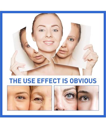 Youngagain Botox Anti-Aging Serum & Firming Eye Cream - Collagen Boost Stock Solution in a Bottle - Buy Online on GoSupps.com