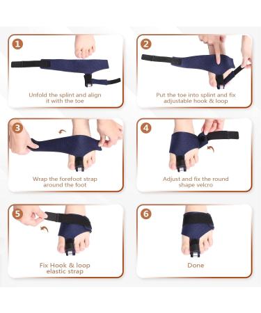 Buy Scurnhau Toe Rail - Ultimate Toe Protection & Hammer Toe Correctors for Claw Toe Support | International Shipping Available - Buy Online on GoSupps.com