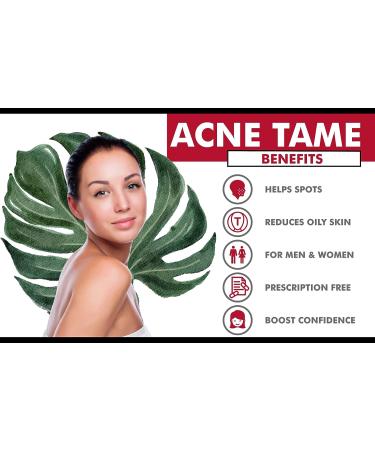 Acne Tame 120 Pills & Estrohalt Combo - Best Solution for Clearing Acne - Buy Online on GoSupps.com