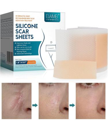 Scar Away Silicone Scar Sheets 1.8 x157 -4M - Medical Grade Tape for Surgical Incisions, C-Section, Keloid, Acne - Painless Scar Removal & Healing Strips - Buy Online on GoSupps.com