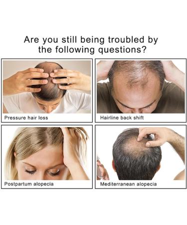 ARTBY Ginger Hair Essence Hair Oils for Hair Growth Hair Strengthening Nourishing Hair Care Essence Conditioner Preventing Hair Loss For Hair Loss Hair Care Artiby - Buy Online on GoSupps.com