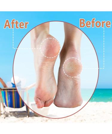 MYCARBON Electric Foot File - Rechargeable Waterproof Callus Remover for Dry, Dead, and Cracked Heels - Pedicure Set for Feet Care - Buy Online on GoSupps.com