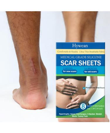 8 Pack Scar Away Silicone Scar Sheets - Breathable & Reusable Silicone Scar Tape - Buy Online on GoSupps.com