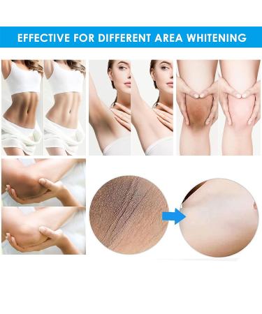 Skin Lightening Cream for Dark Spots & Hyperpigmentation - Underarms, Knees, Elbows, Inner Thigh, Bikini Area | Body Whitening & Bleaching Treatment - Buy Online on GoSupps.com