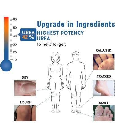 Urea Foot Cream 42% Urea Cream Cracked Heel Repair Cream for Feet and Hand Foot Cream for Callus Remover & Nourishes Soften Maximum Strength for Hand Foot And Body Care(150g) - Buy Online on GoSupps.com