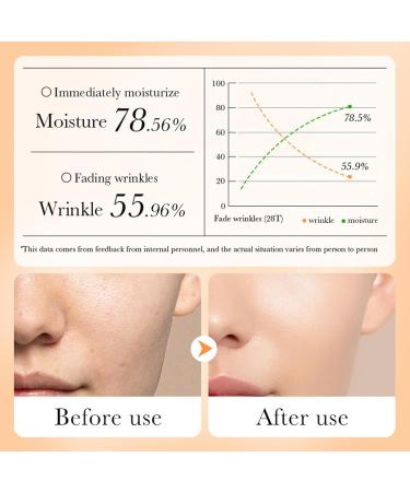 cypreason Carrot Face Cream for Dry Skin - Carrot Skin Care with Retino for Women and Men - Moisturizing Face Cream for Dry and Oily Skin - Buy Online on GoSupps.com