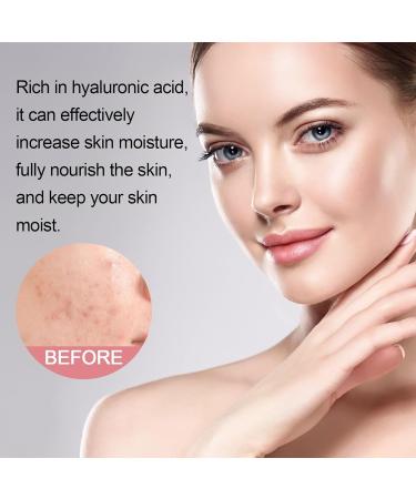 FFEEJ 5-in-1 Cleansing Mousse Deep Cleansing Facial Foam Moisturizing Oil-Control Face Wash For Acne Marks Reduction Gentle Formula - Buy Online on GoSupps.com