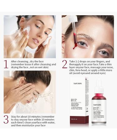 AHA 30% + BHA 2% Peeling Solution for Face - Exfoliating Chemical Peel at Home - Fine Line & Wrinkle Treatment - 1 fl oz - Buy Online on GoSupps.com
