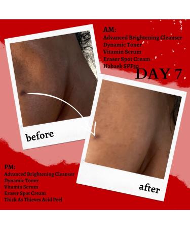 Shop Gymsegb Eraser Cream - 1 oz for Flawless Skin | International Shipping Available - Buy Online on GoSupps.com