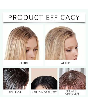 Hair Leave In Volume Styling Spray No Rinse Hair Spray 120 Ml High Fluffy Spray Dry Hair Spray Long Lasting Oil Control Volume Non Sticky Fresh and Clean Suitable for Men and Women (2PCS) - Buy Online on GoSupps.com