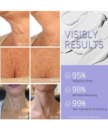 2024 New Pure Neck Firming Cream - Anti-Aging Tighten & Lift Moisturizing Neck Cream for Men & Women Reduces Wrinkles Evens Skin Tone - 1.7 oz - Buy Online on GoSupps.com