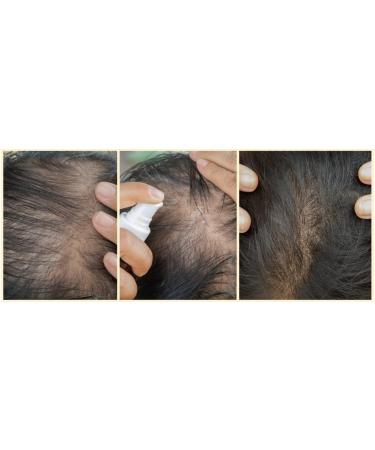 GR-7 Lotion in Spray and 60 Hair Capsules for Hair Loss Men and Women - Against Hair Loss - Hair Growth Agent Men - Anti Hair Loss - Hair Growth Accelerate Anti Hair Loss Lotion Spray + Complex Hair Support - Buy Online on GoSupps.com