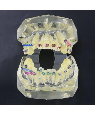Dental Orthodontic Demonstration Model - Arch Wire Metal Bracket for Teaching & Study (Clear) | International Shipping - Buy Online on GoSupps.com