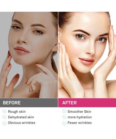 Ellocy Face Wrinkle Patches - 192PCs Forehead & Facial Tape for Anti-Wrinkles - Buy Online on GoSupps.com