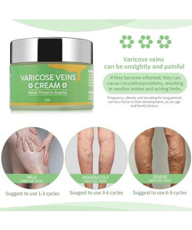 EXQST Varicose Veins Cream CremePure Varicose Veins Leg Cream - Buy Online on GoSupps.com