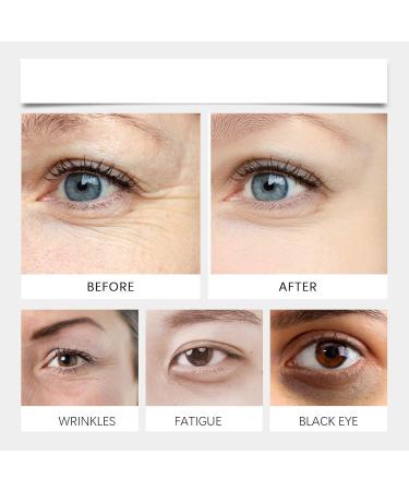 Timing Erasers Rollerball - Castor Oil & Frankincense Eye Roller Set for Moisturizing Anti-Wrinkle & Fine Lines (2 PCS) International Shipping - Buy Online on GoSupps.com