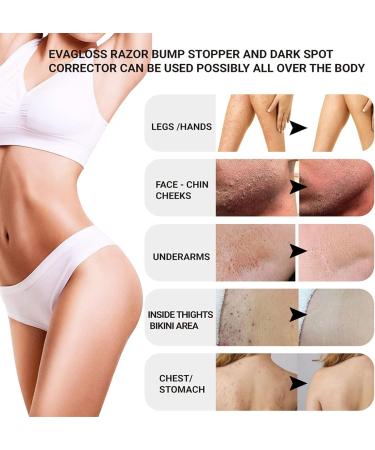 Hair Inhibitor 100ml Roll-on Serum for Ingrown Hair & Razor Bumps | After Shave Repair Solution for Men & Women | Skin Lightening for Bikini Area, Legs & Underarms - Buy Online on GoSupps.com