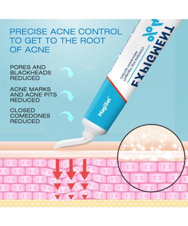  MagiSel Facial cream for acne-prone skin plant-based anti-blemish cream 20g moisturizing face cream hydrates and leaves skin feeling smooth gentle formula - Buy Online on GoSupps.com