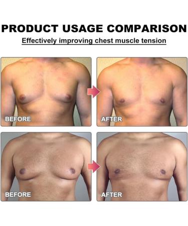 Mentherm Bee Venom Oil for Gynecomastia - 15ml | Strengthen Chest Muscles (3 Pieces) - International Shipping Available - Buy Online on GoSupps.com