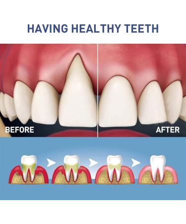 Whitening Gel Pen Teeth Whitening Pen Easy and Effective Teeth Whitening Teeth Whitening Pen Whiten Teeth Easily Teeth Care Whitening (5) - Buy Online on GoSupps.com