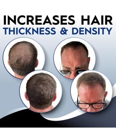 Natural Hair Growth Foam - Biotin & Keratin Formula for Men & Women | Promotes Regrowth & Strength - Pack of 3 (1.22 oz - Buy Online on GoSupps.com