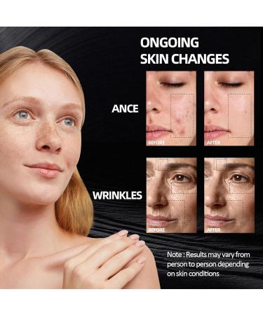 Buy LED Light Therapy Mask - Red Blue & Near-Infrared for Acne & Wrinkle Treatment - International Shipping Available - Buy Online on GoSupps.com