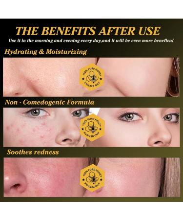 Beef Tallow for Skin Face Lips & Body - 100% Organic Grass-fed Whipped Tallow and Honey Balm - Perfect Moisturizer Cream for Dry Cracked Sensitive or Delicate Skin (4.23Oz) - Buy Online on GoSupps.com