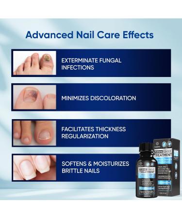Extra Strength Toenail Fungus Treatment 30ML - Fast Relief for Men & Women | Nail Fungus Cure - Buy Online on GoSupps.com