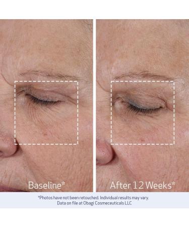 Obagi ELASTIderm Lift Up & Sculpt Facial Moisturizer Clinically Proven Anti-Aging Face Cream that Visibly Firms & Sculpts Facial Contours & Reduces Fine Lines & Wrinkles with Peptides 1.7 oz - Buy Online on GoSupps.com