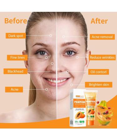PAWPAW Exfoliating Gel Vitamin C Facial Scrub Exfoliating Face Wash Natural Papaya Face & Body Scrub Cleansing & Brightening Moisture Facial Scrub Exfoliator For Dull & Blackhead & Even Tone - Buy Online on GoSupps.com