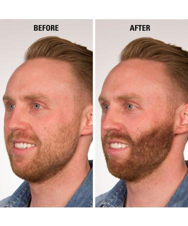 Infinity Hair Fibers - Thicker Fuller Hair for Men & Women | 14g Medium Brown | Conceal Thin Hair Effortlessly - Buy Online on GoSupps.com