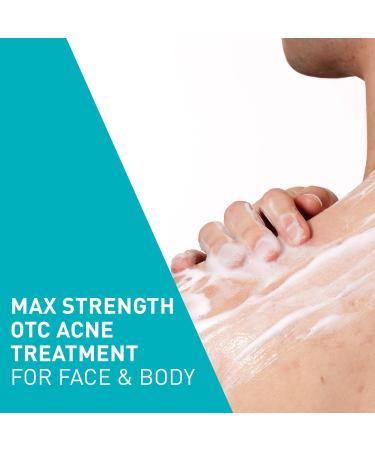 CeraVe Acne Foaming Cream Wash - 10% Benzoyl Peroxide Acne Cleanser Hyaluronic Acid & Niacinamide | Treats Pimples Blackheads & Body Acne - 5 Oz - Buy Online on GoSupps.com