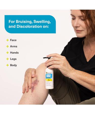 Pure Relief Arnica Bruise Relief Lotion for Bruising Swelling & Discoloration On Skin Natural Skin Care Arnica Bruise Homeopathic Topical Bruise Cream W/Aloe Vera & Collagen 4 Fl Oz (Pack of 3) - Buy Online on GoSupps.com