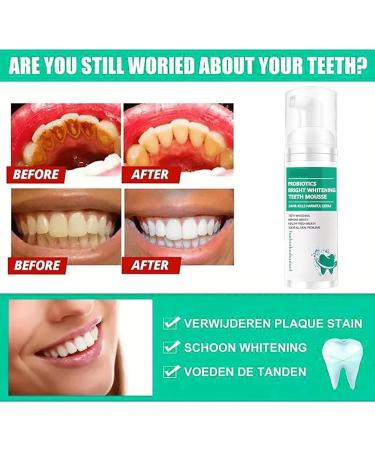 Lenaro Probiotics Teeth Whitening Mousse - 2PCs Herbal Oral Repair for Bright Smiles & Fresh Breath - Buy Online on GoSupps.com