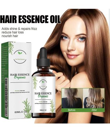 Shelure Hair Growth Oil Shelure Hair Regrowth Oil Shelure Hair Regrowth Treatment Oil Natural Hair Growth Oil Hair Regrowth Extract Oil Hair Growth Oil for Women (2) - Buy Online on GoSupps.com