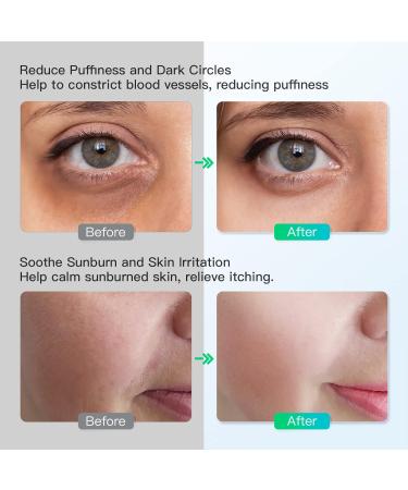 Iborria Ice Roller for Face - Dual Roller Heads for Swelling & Migraine Relief - Blue Ice Face Massager - Buy Online on GoSupps.com